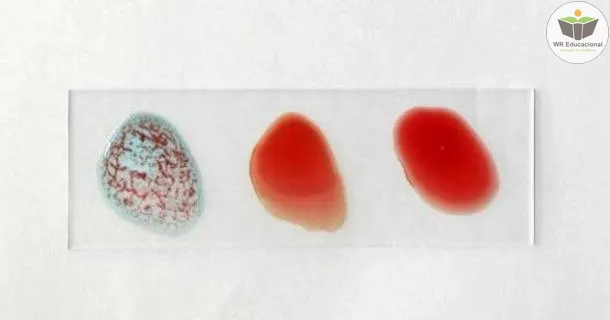 Curso de educação a distância de Auxiliar de Imunohematologia
